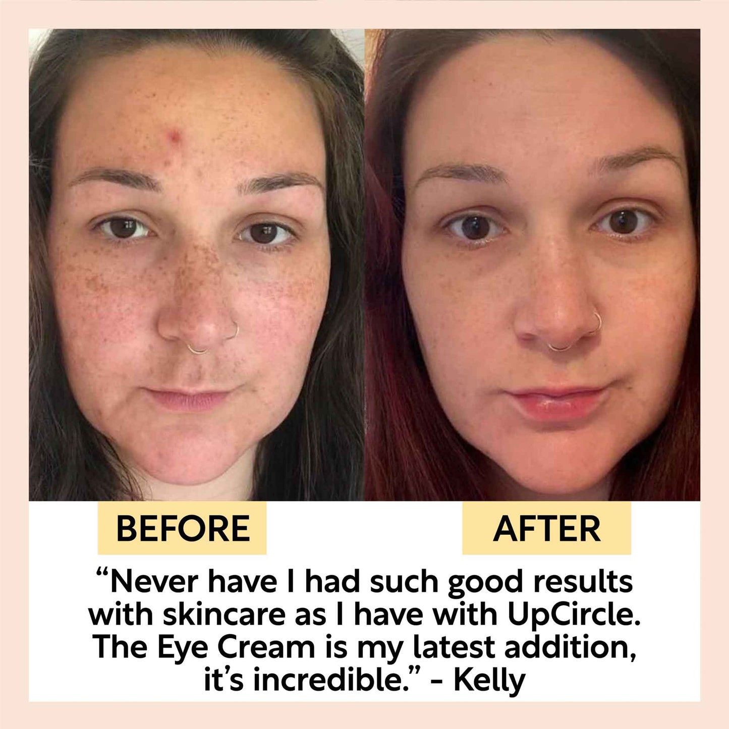 Eye Cream with Hyaluronic Acid & Coffee
