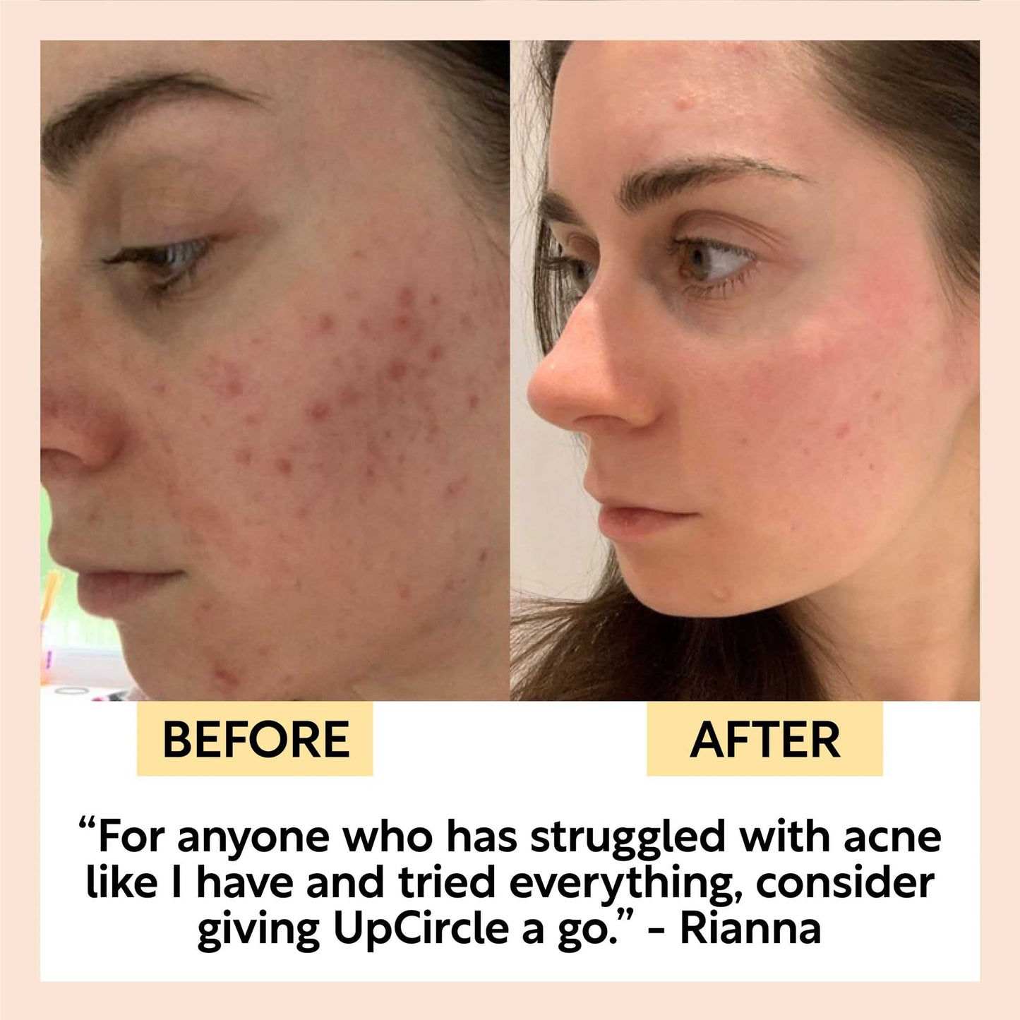 Face Toner with Hyaluronic Acid - Travel Size